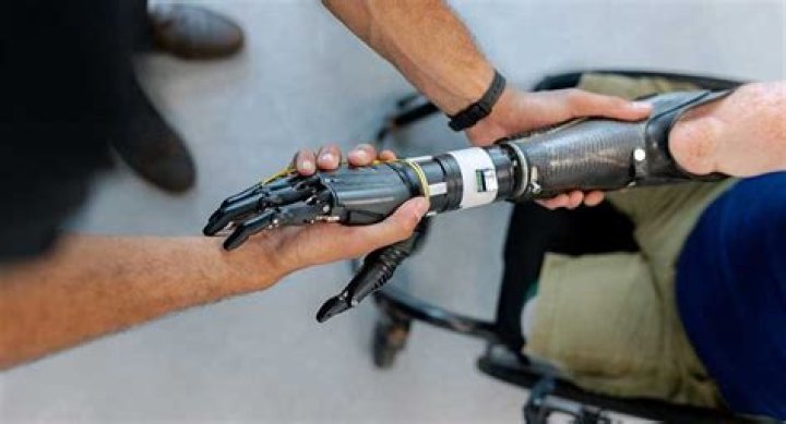 How much does a prosthetic robot arm cost?