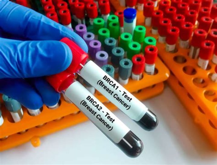 How much does BRCA test cost?