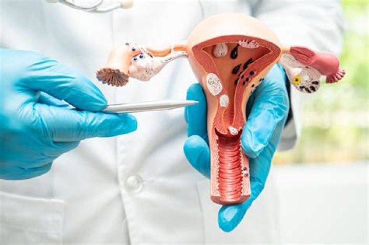 How much is a Mirena IUD in Australia?