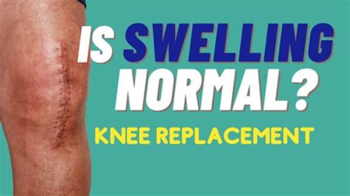 How much swelling is normal after gelding?