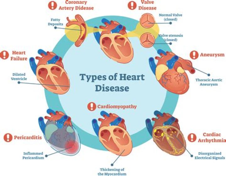 How will Ischaemic heart disease affect the ECG pattern?