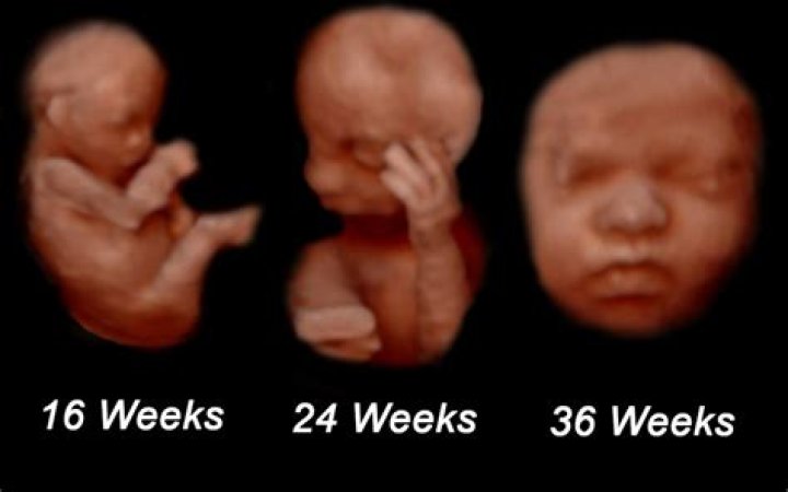 Is 4D bad for the baby?