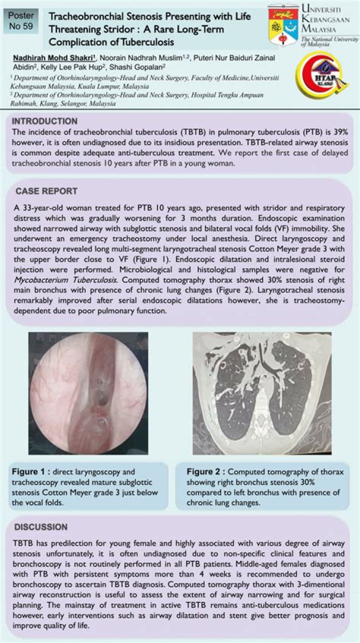 Is bronchial stenosis life threatening?