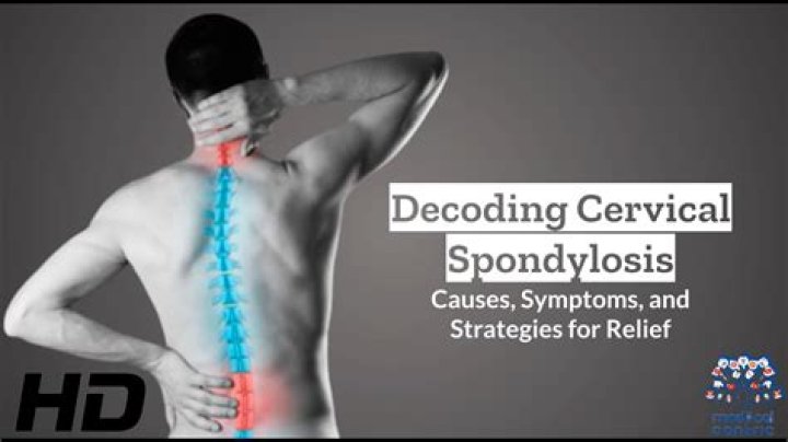 Is cervical spondylosis with myelopathy serious?