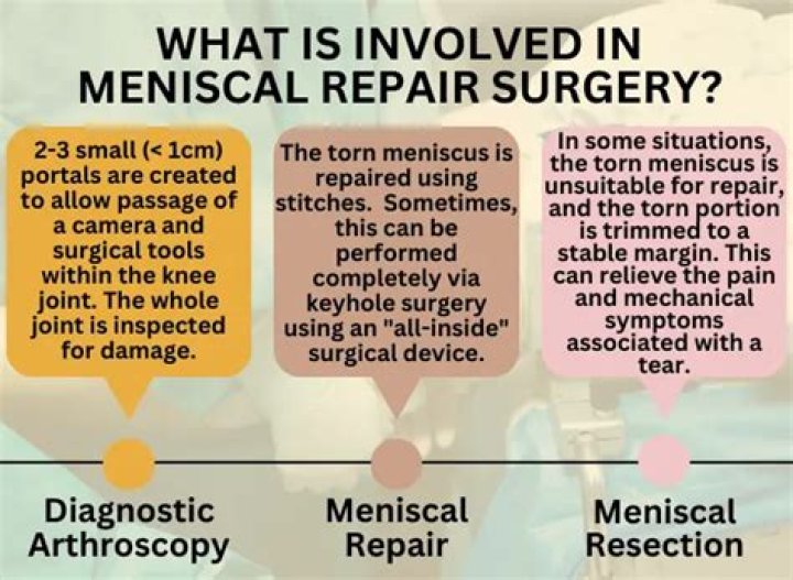 Is meniscus surgery a major surgery?