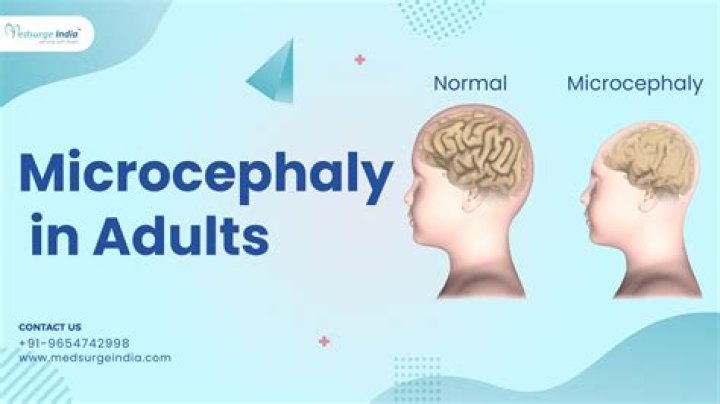 Is microcephaly a disability?