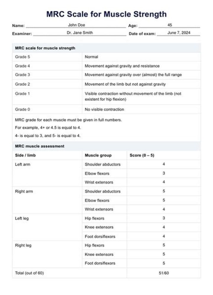 Is MRC the same as SKF?