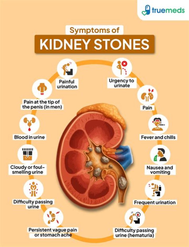 Is nausea a side effect of kidney stones?