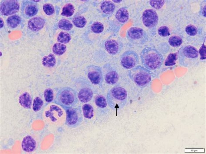 Is plasmacytoma in dogs cancerous?