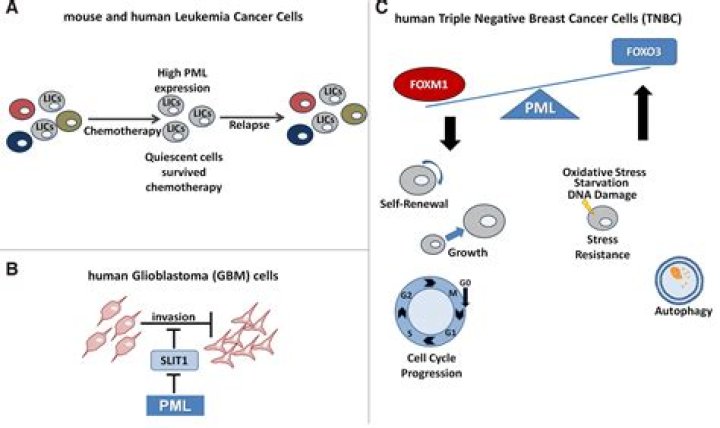 Is PMLE cancerous?