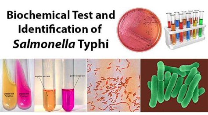 Is Salmonella typhimurium urease positive or negative?