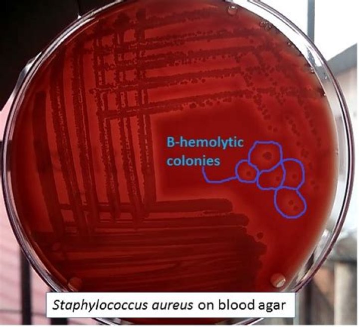 Is staph Simulans beta hemolytic?