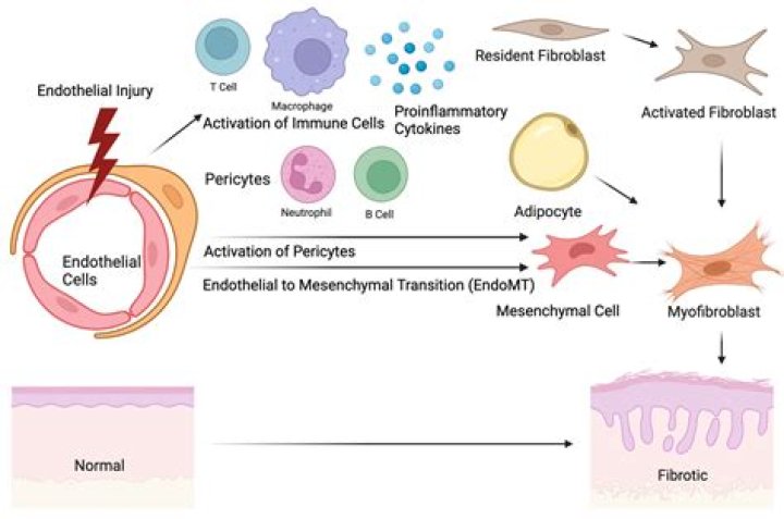 Is systemic sclerosis hereditary?