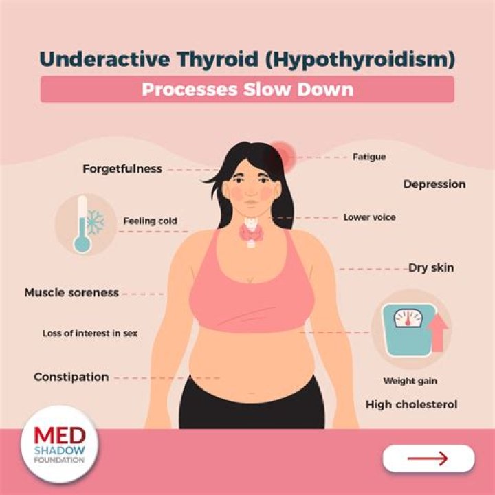 Is urticaria related to thyroid?
