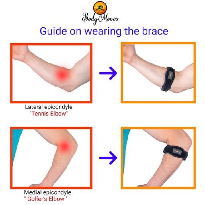 Should you strap up tennis elbow?