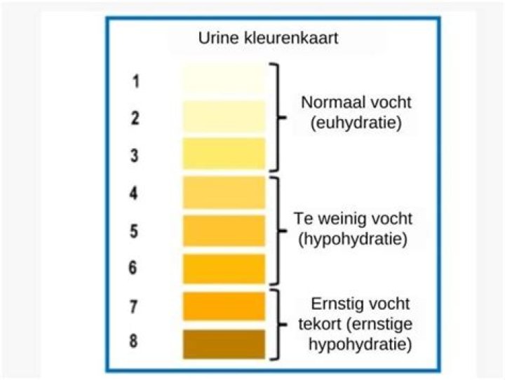 Wat is een donkere urine?