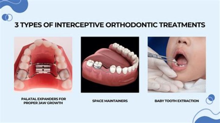 What are included in interceptive orthodontics?
