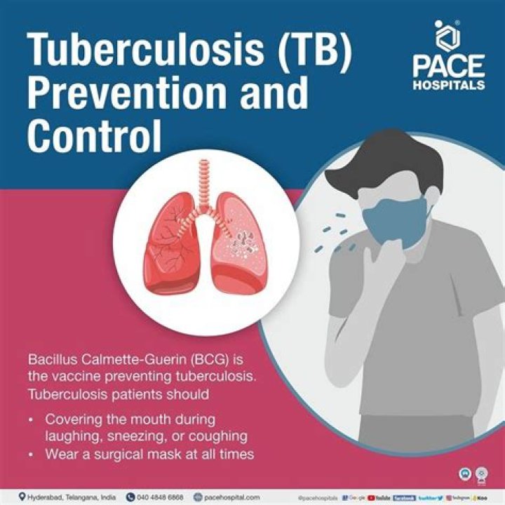 What are levels of prevention for tuberculosis?