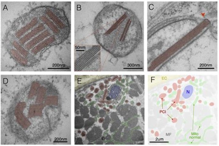 What are Paracrystalline inclusions?