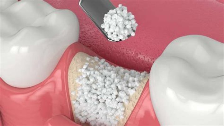 What are pre operative instructions dental?