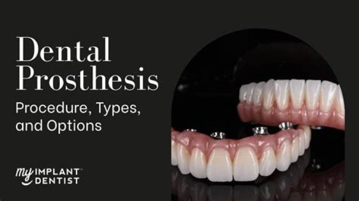 What are prosthetic teeth called?
