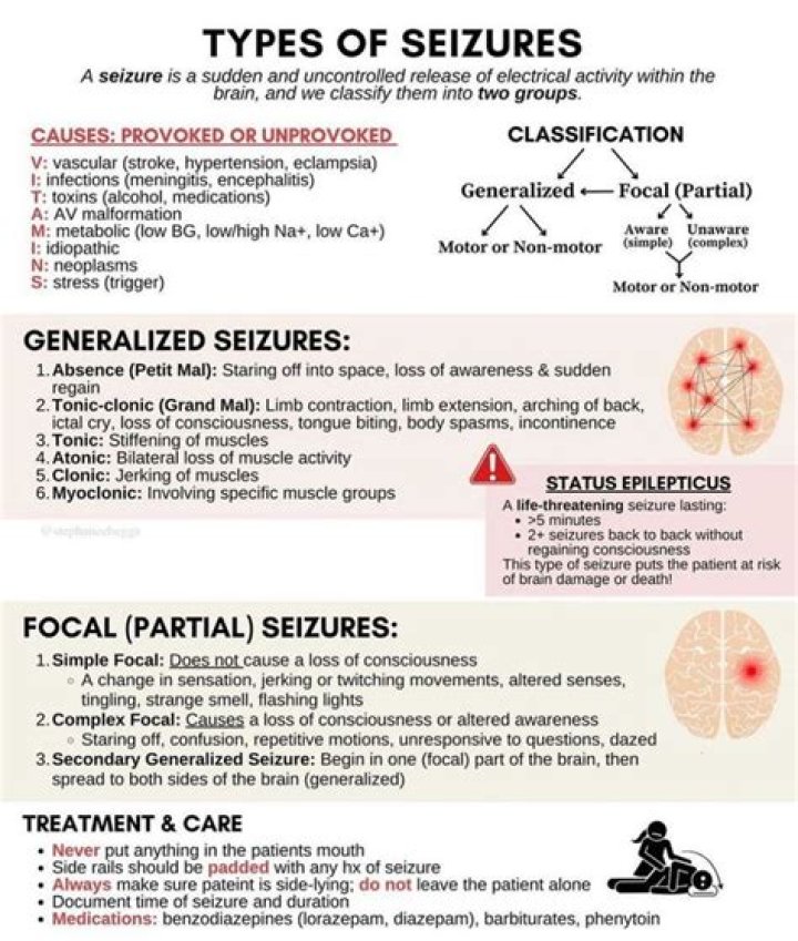 What are the 3 main types of seizures?