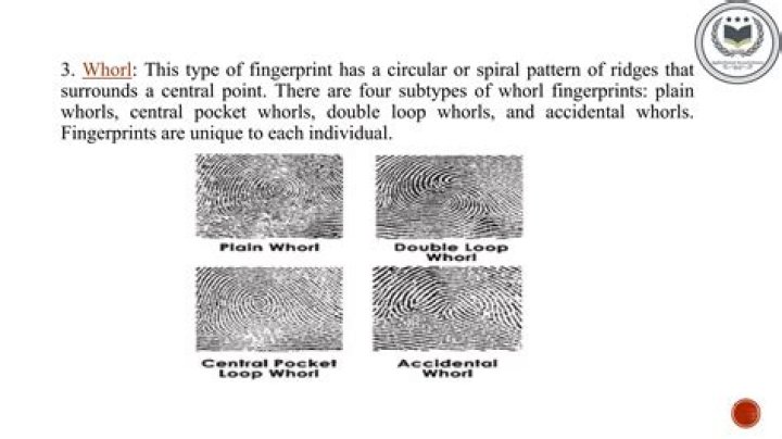 What are the 4 types of whorl fingerprints?