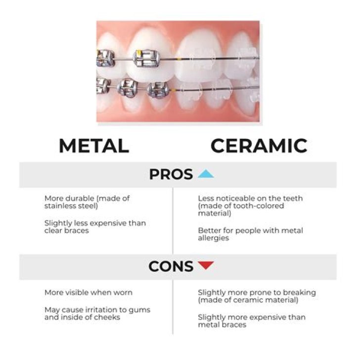 What are the advantages of ceramic braces?