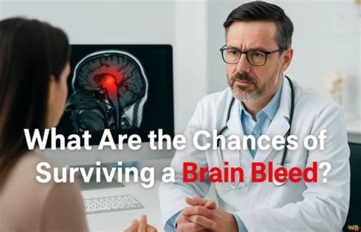 What are the chances of surviving a brain bleed?