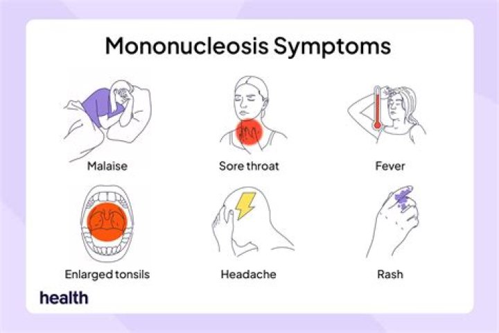 What are the signs and symptoms of Mono?