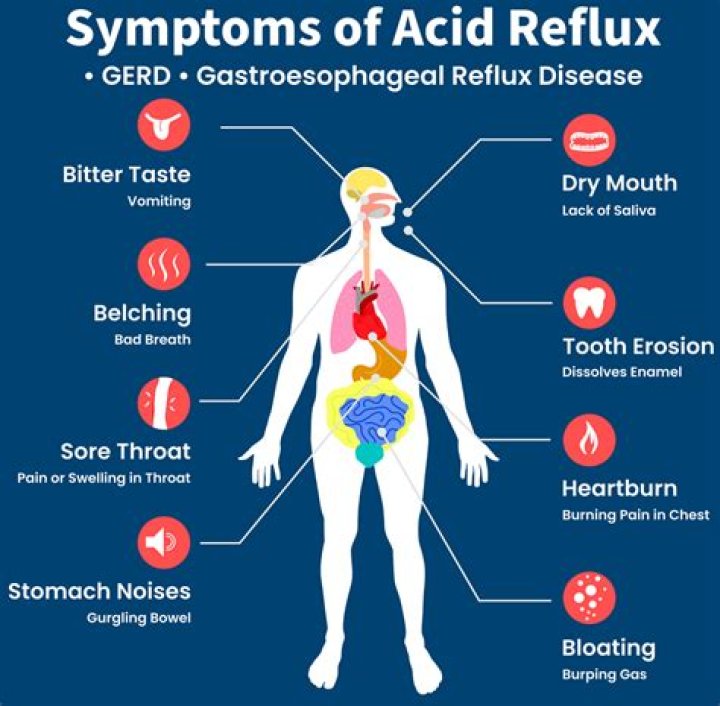What are the symptoms of acid reflux in adults?