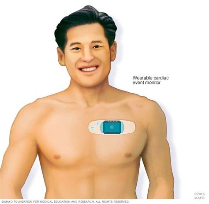 What are the types of cardiac monitoring?