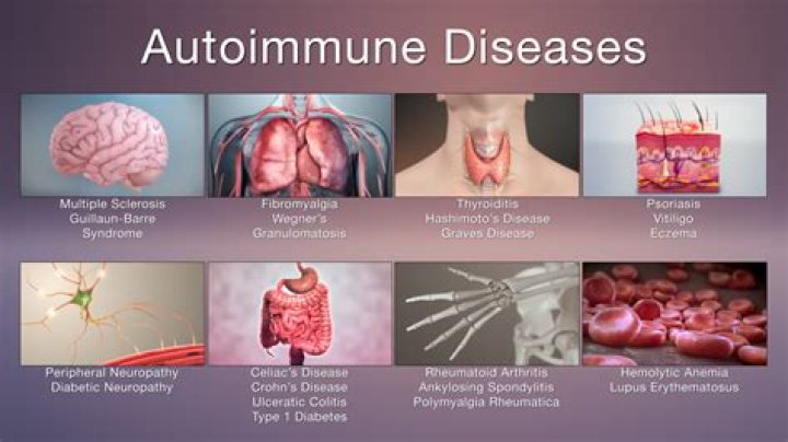What autoimmune disease affects teeth?