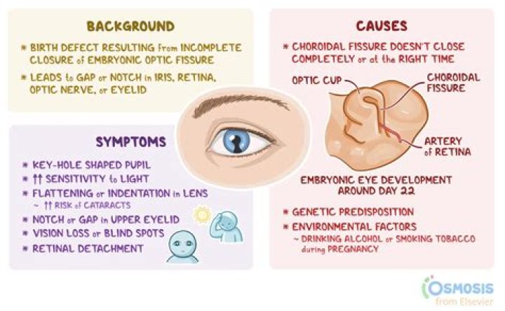 What causes a coloboma?