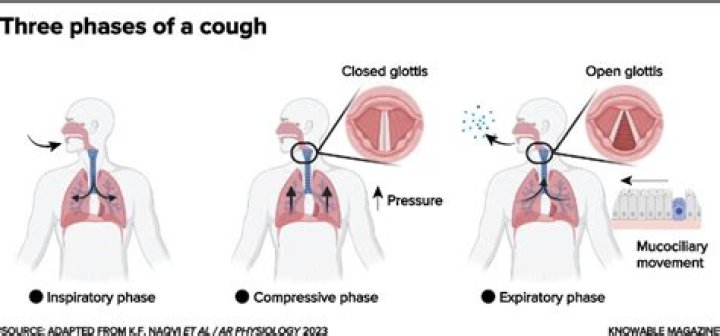 What causes a cough with no fever?