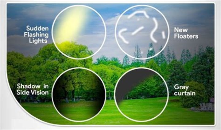 What causes black shadows in your vision?