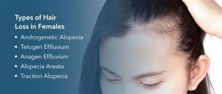 What causes hair loss in 20 year old female?