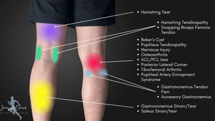 What causes pain in the anterior tibial region of the lower leg?