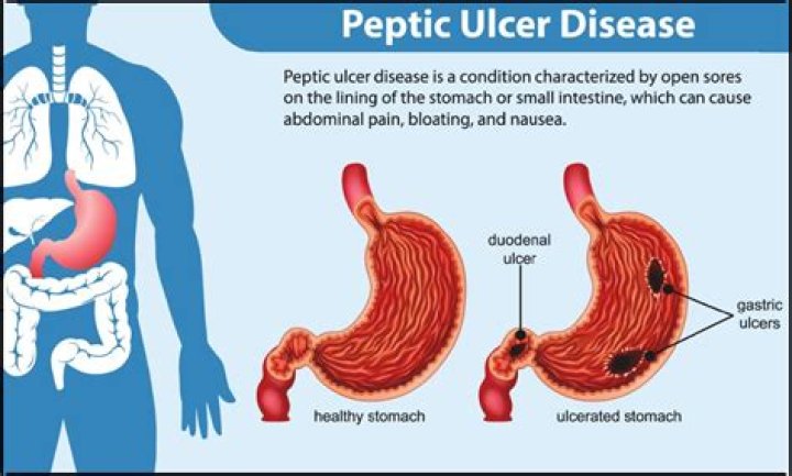 What causes ulcers on your liver?
