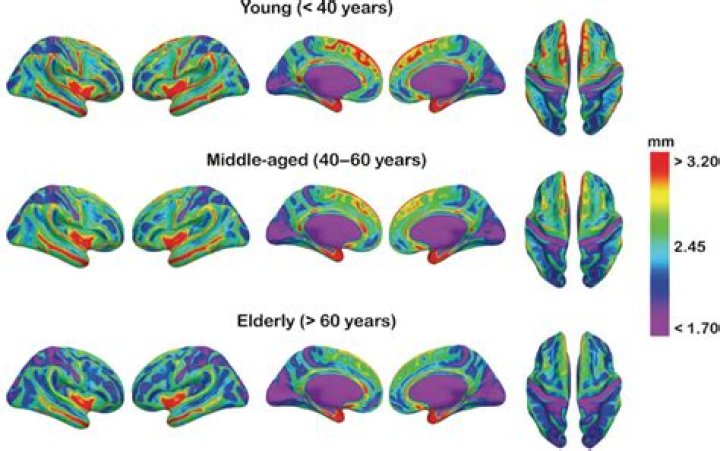 What causes volume loss in the brain?