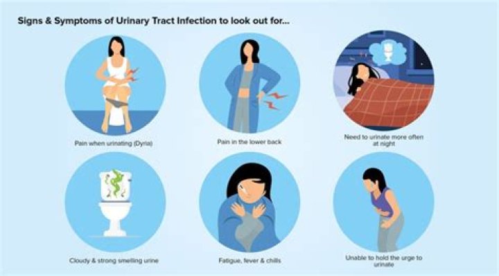 What condition is associated with urinary stasis?