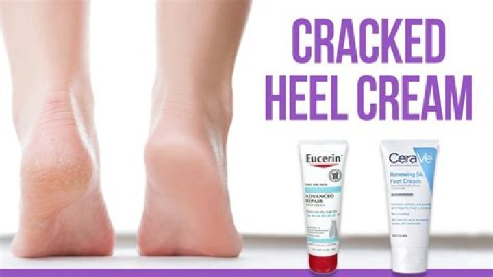 What cream is good for dry cracked heels?