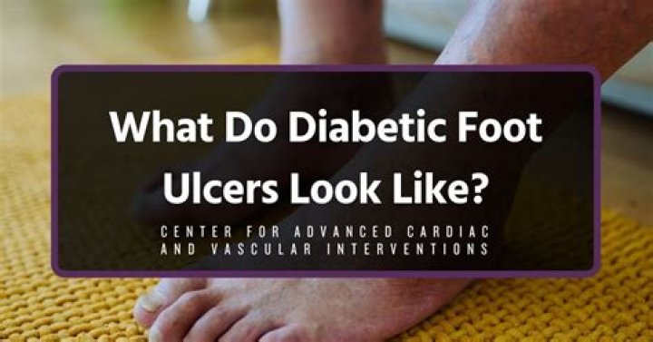 What do diabetic lesions look like?