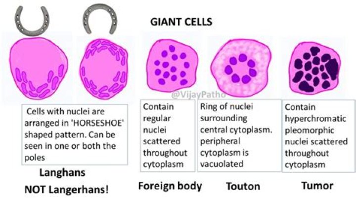What do giant cells indicate?
