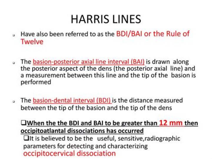 What do Harris lines indicate?