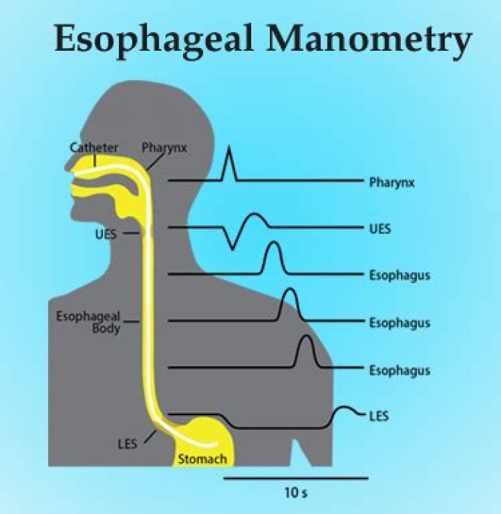 What does esophageal manometry tell you?