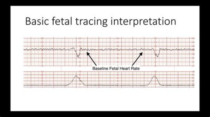 What does FHR Category 1 mean?