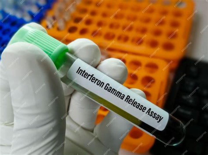 What does interferon gamma do in TB?