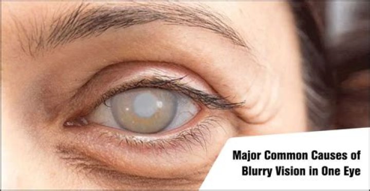 What does it mean when your peripheral vision is blurry in one eye?