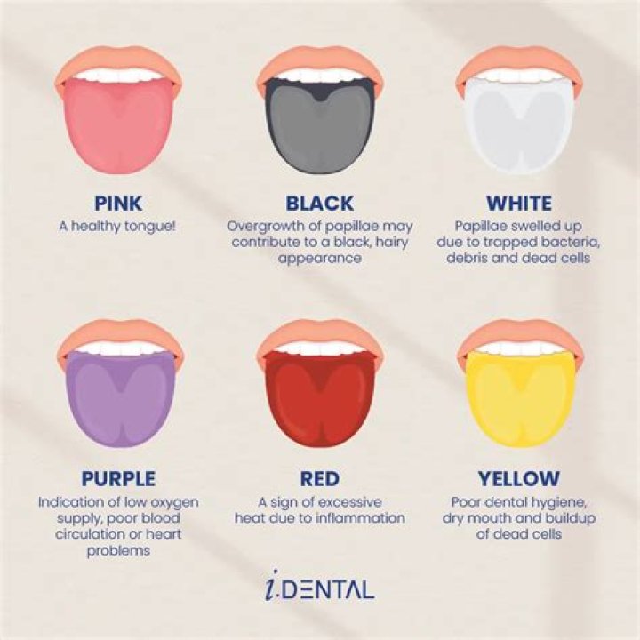 What does it mean when your throat wheezes?